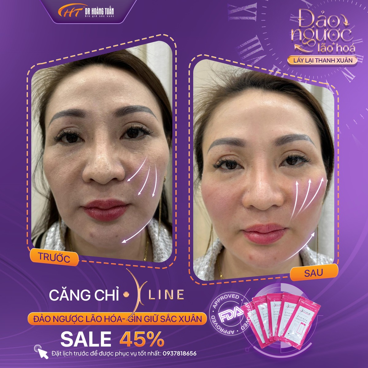 phương pháp trẻ hóa da mặt