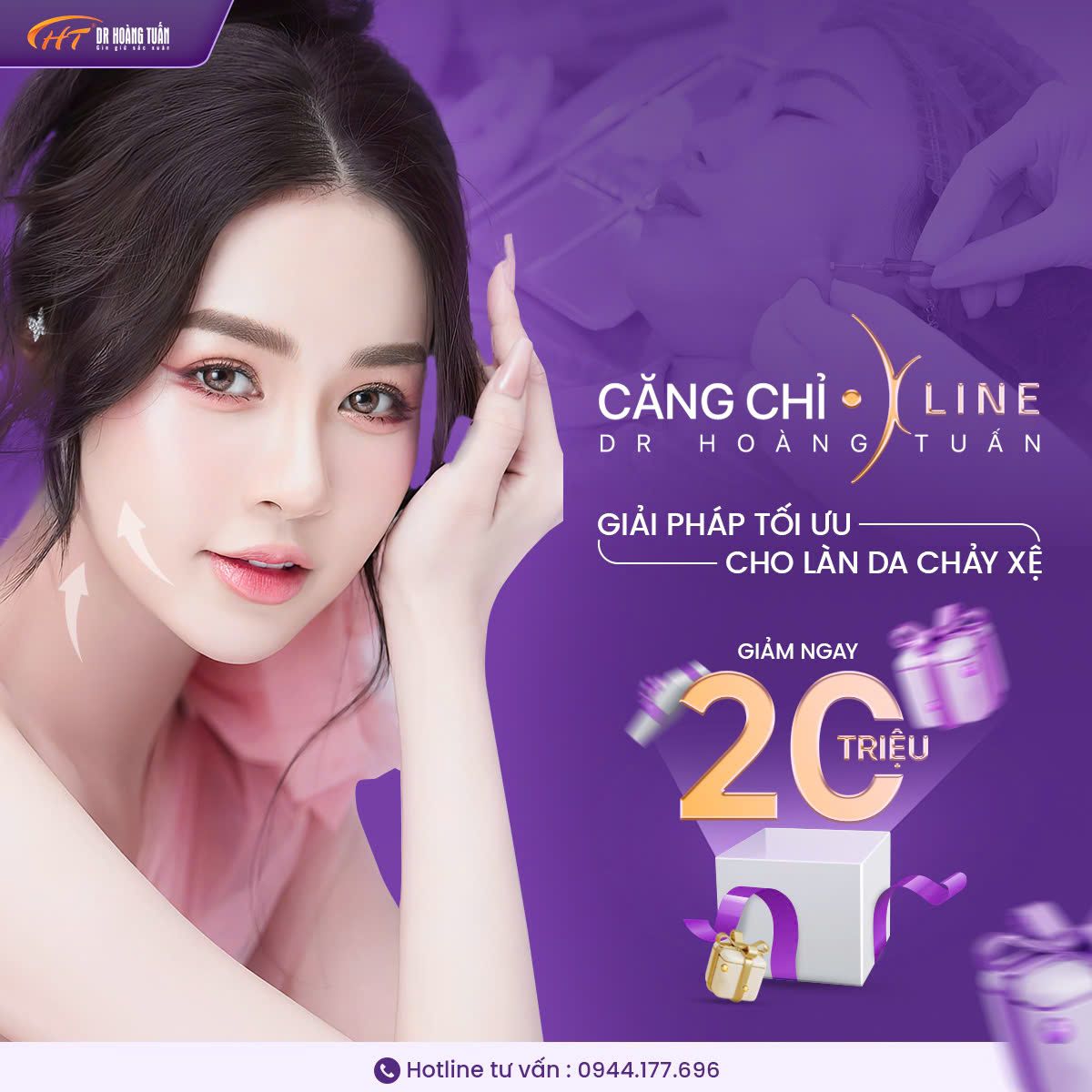 căng da mặt bằng chỉ có hại không