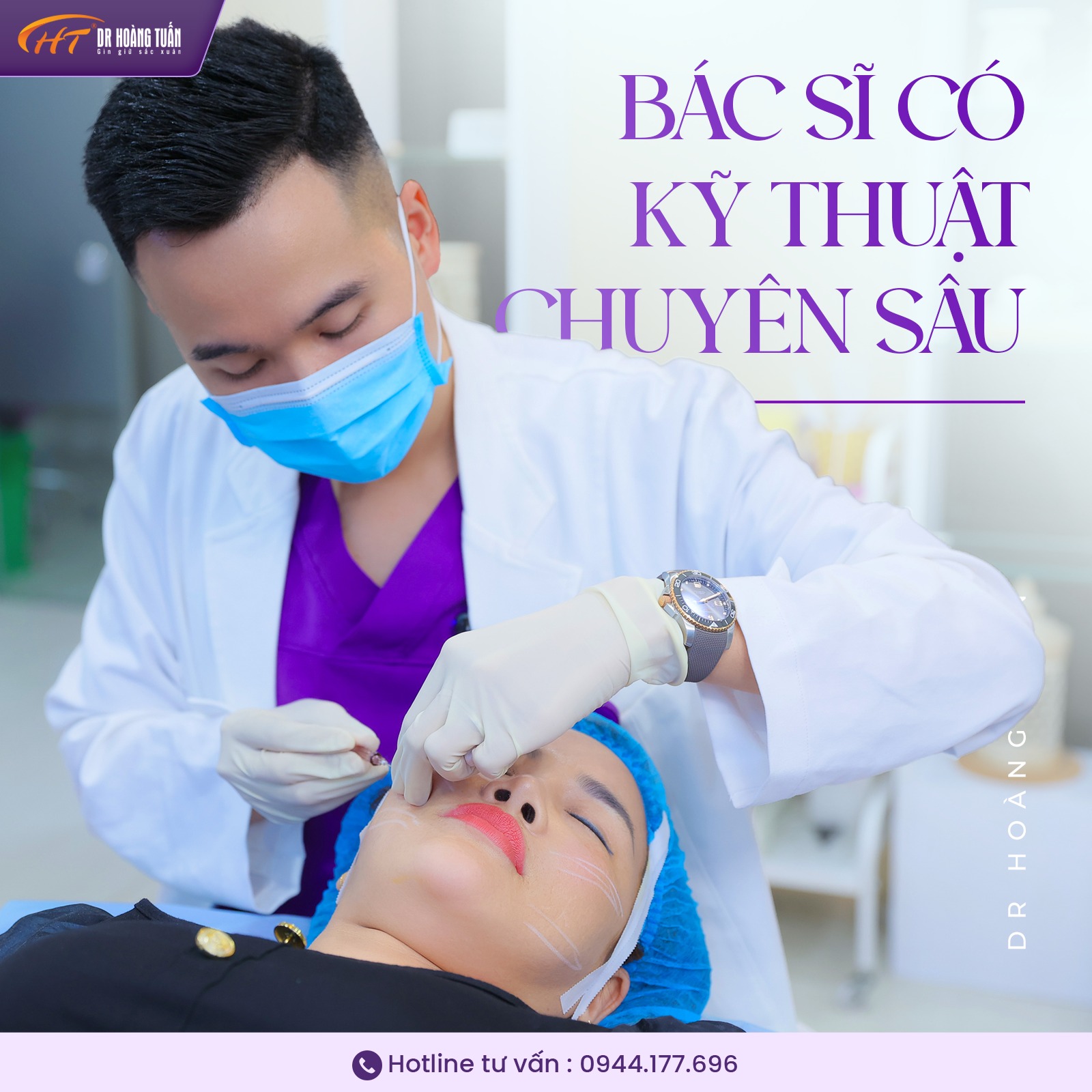 Căng chỉ da mặt được bao lâu