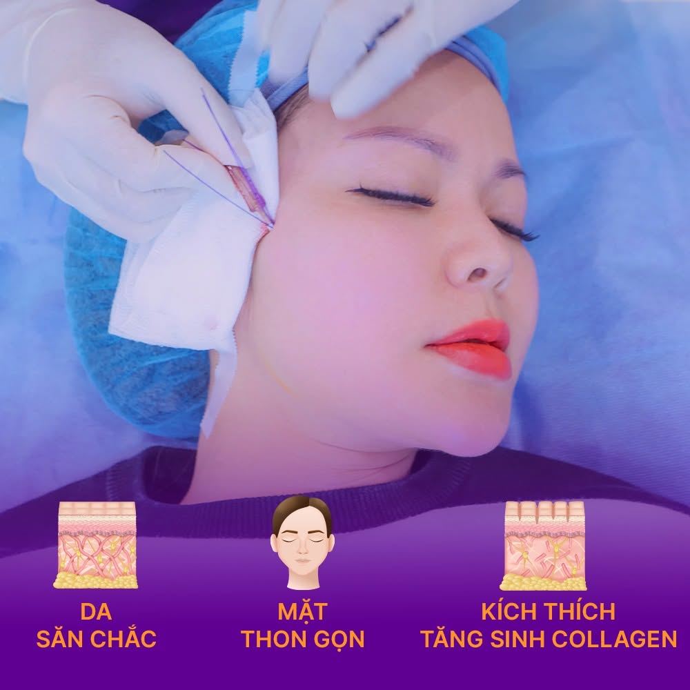 căng chỉ thái dương