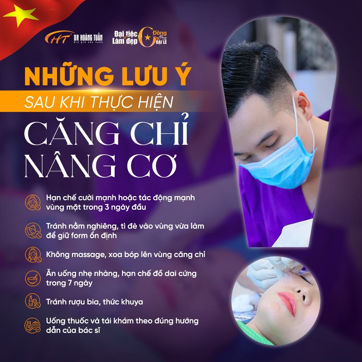 căng chỉ thái dương