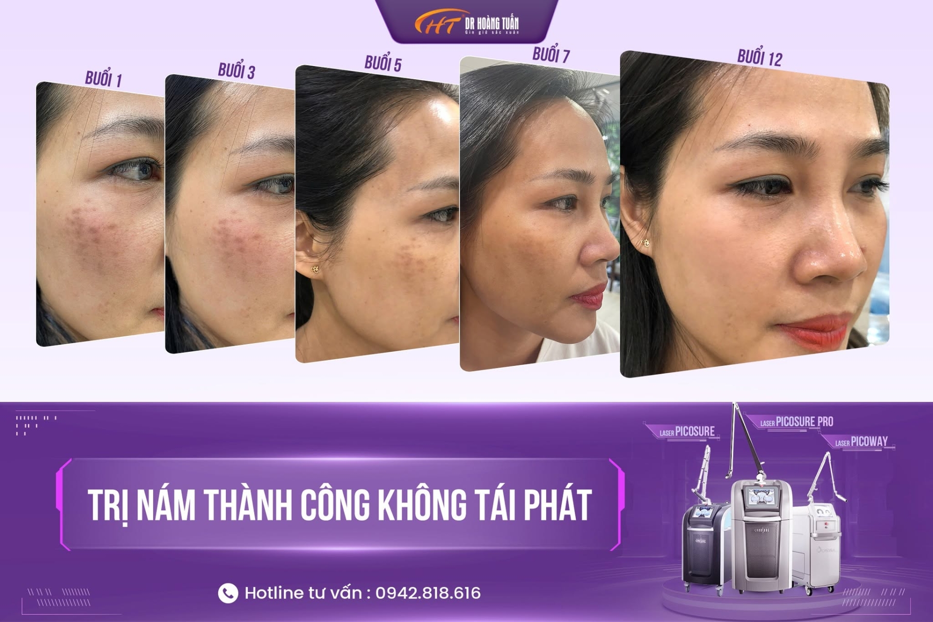 nám đốm