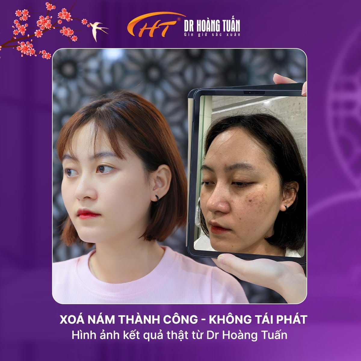 nám đốm