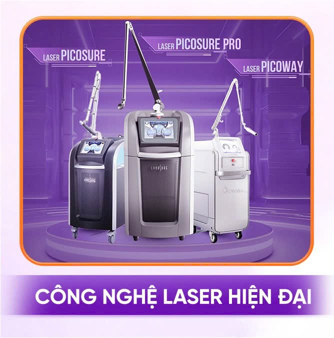 điều trị nám bằng laser bao nhiều lần