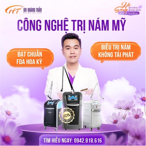 laser điều trị nám
