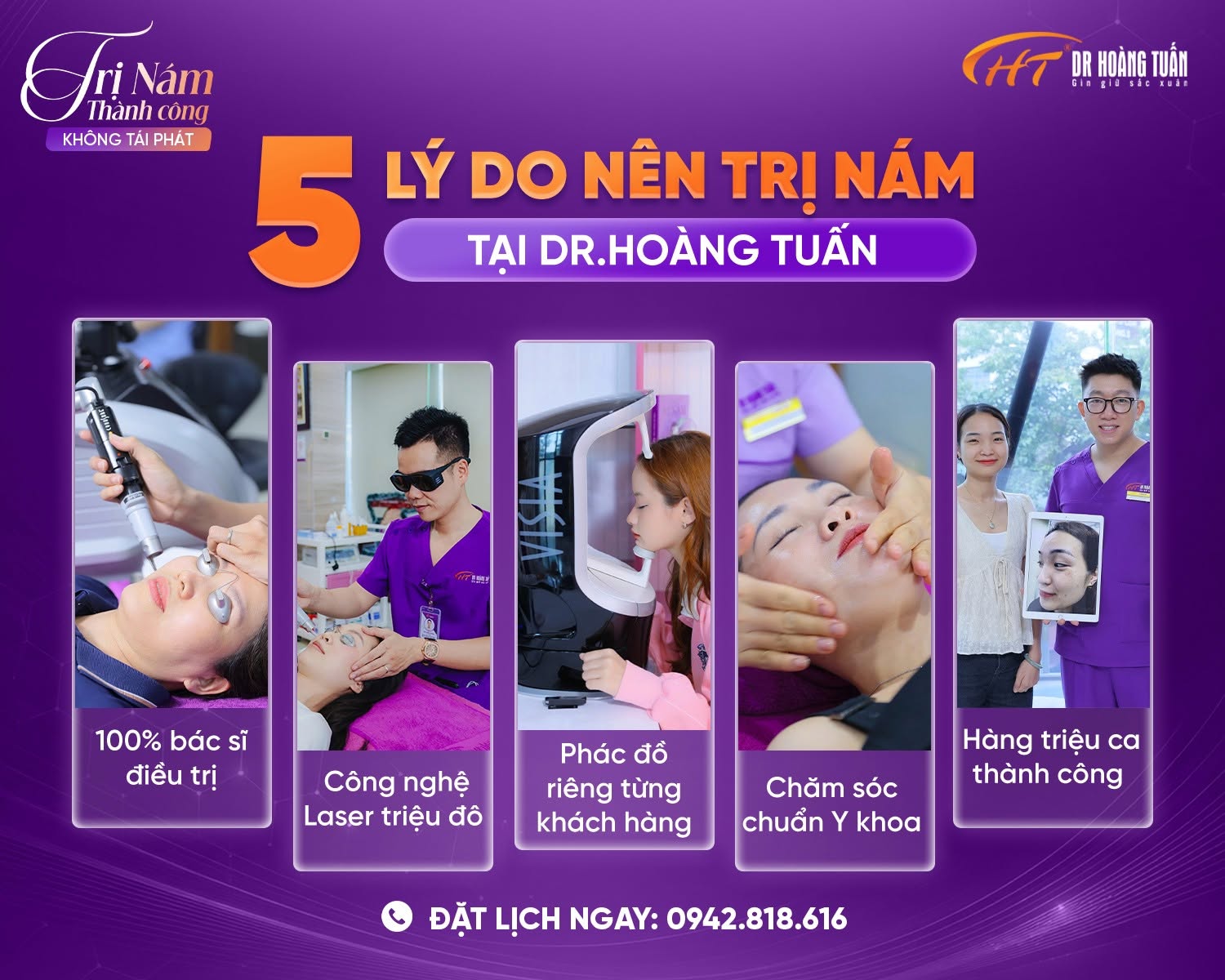 điều trị nám chuyên sâu