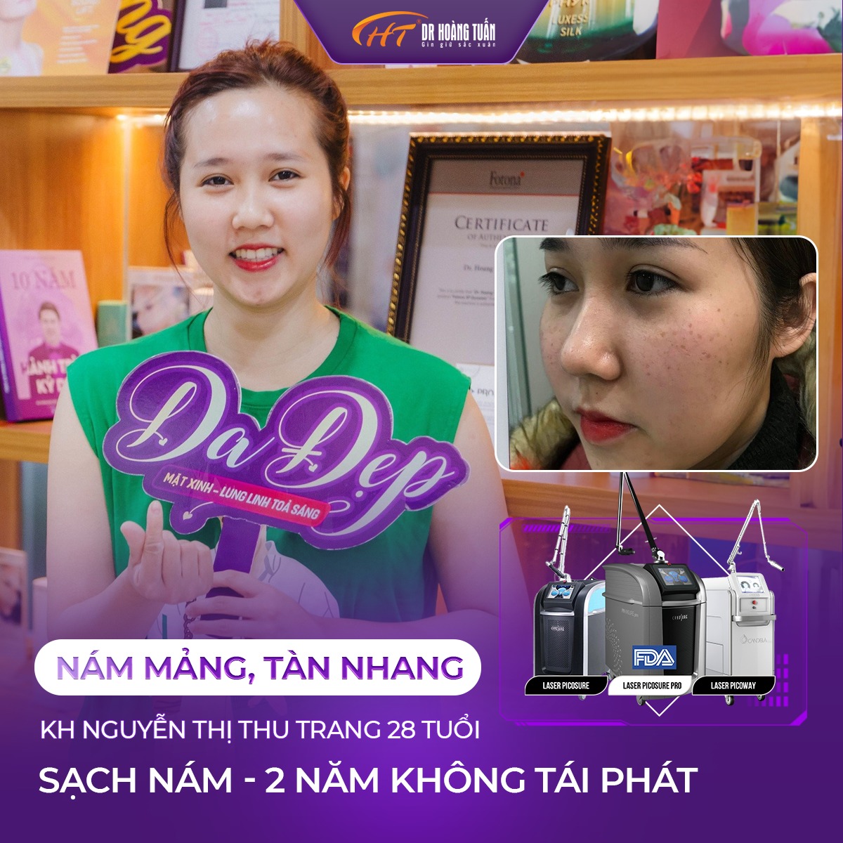 trị nám lâu năm