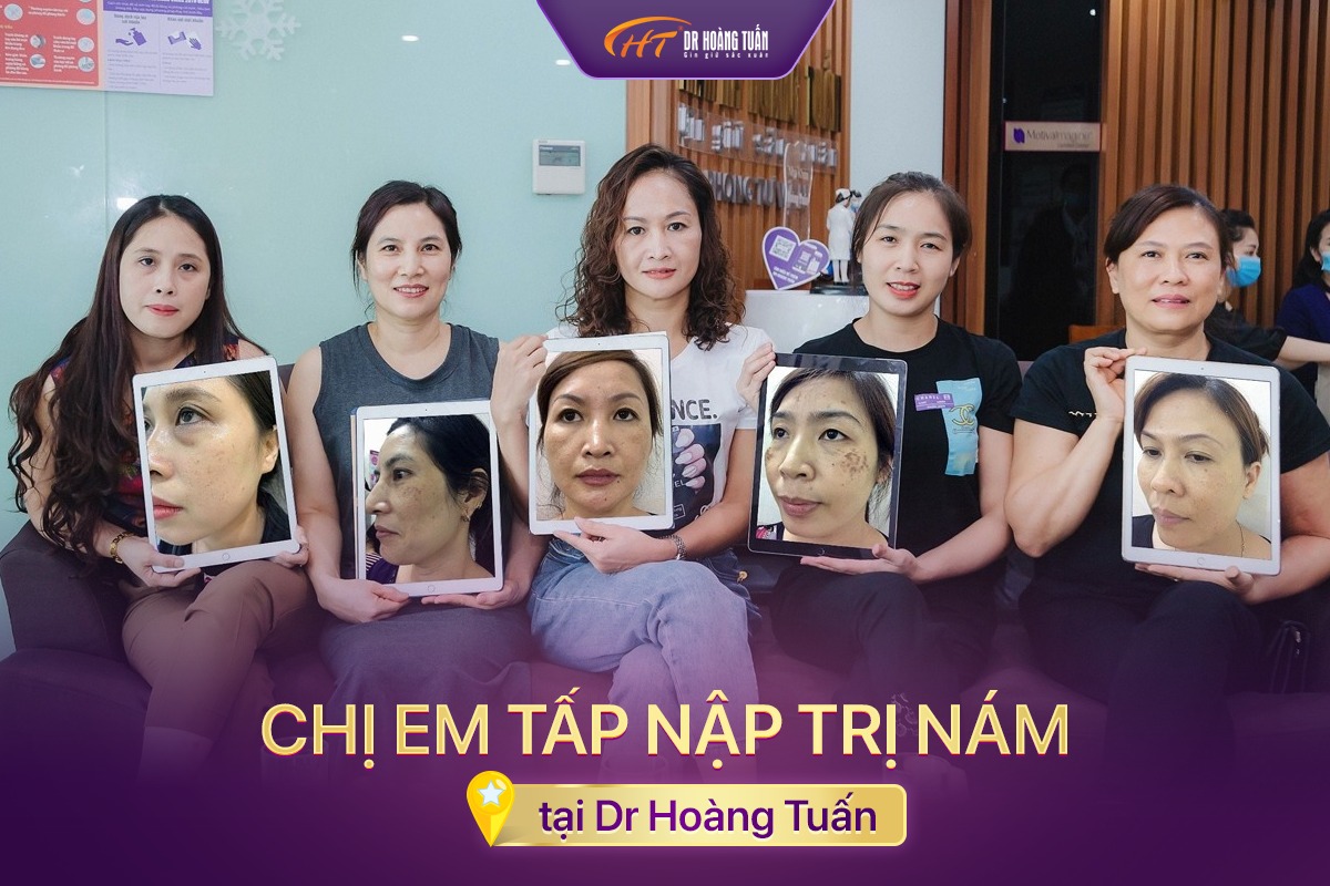 hình ảnh nám