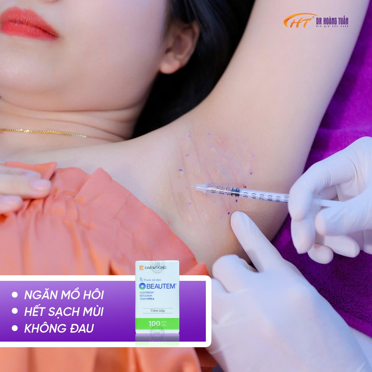 tiêm botox trị hôi nách