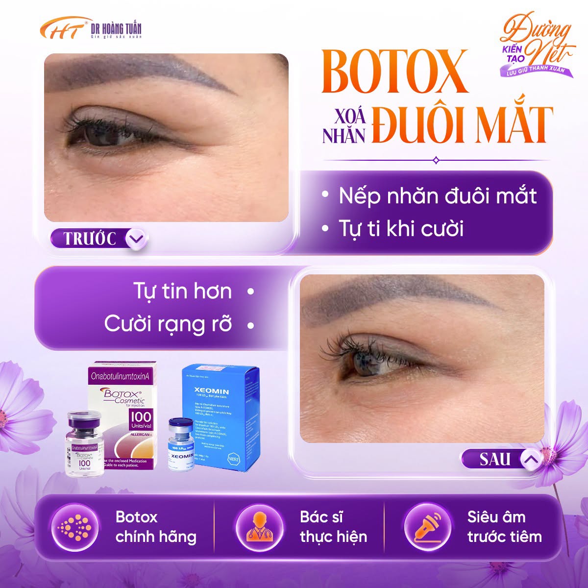 tiêm botox xóa nhăn bao lâu có hiệu quả