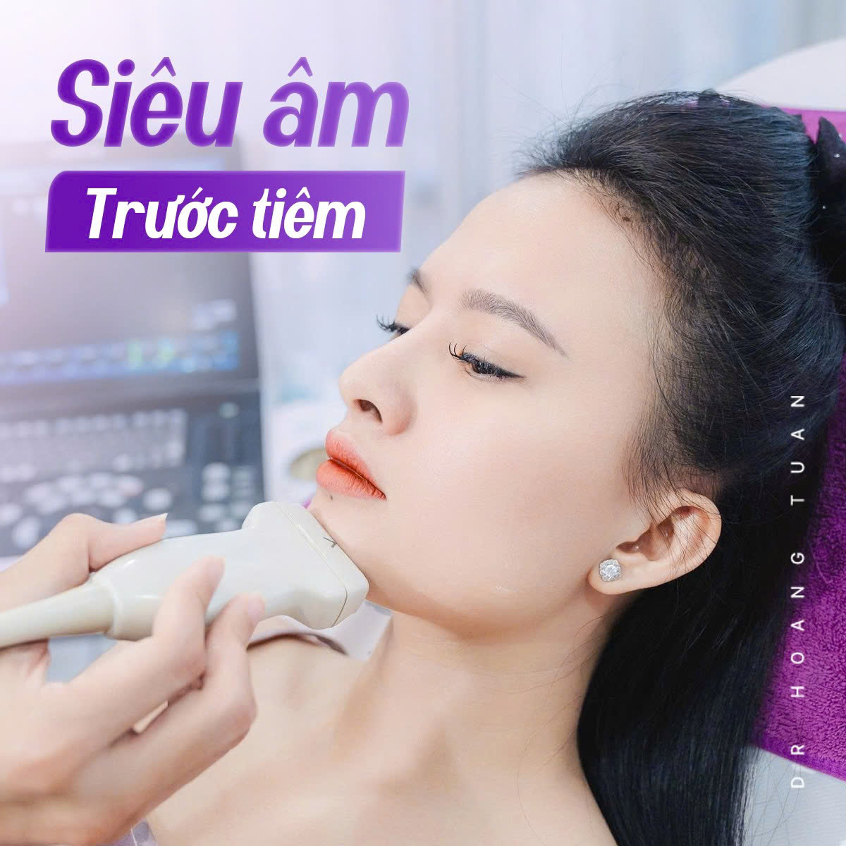 tiêm filler cằm có được nặn mụn không