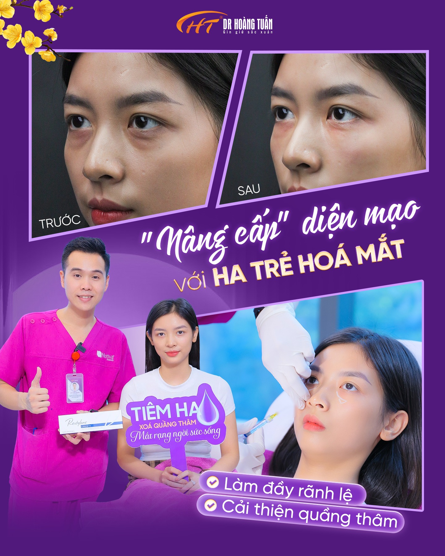 tiêm ha mắt