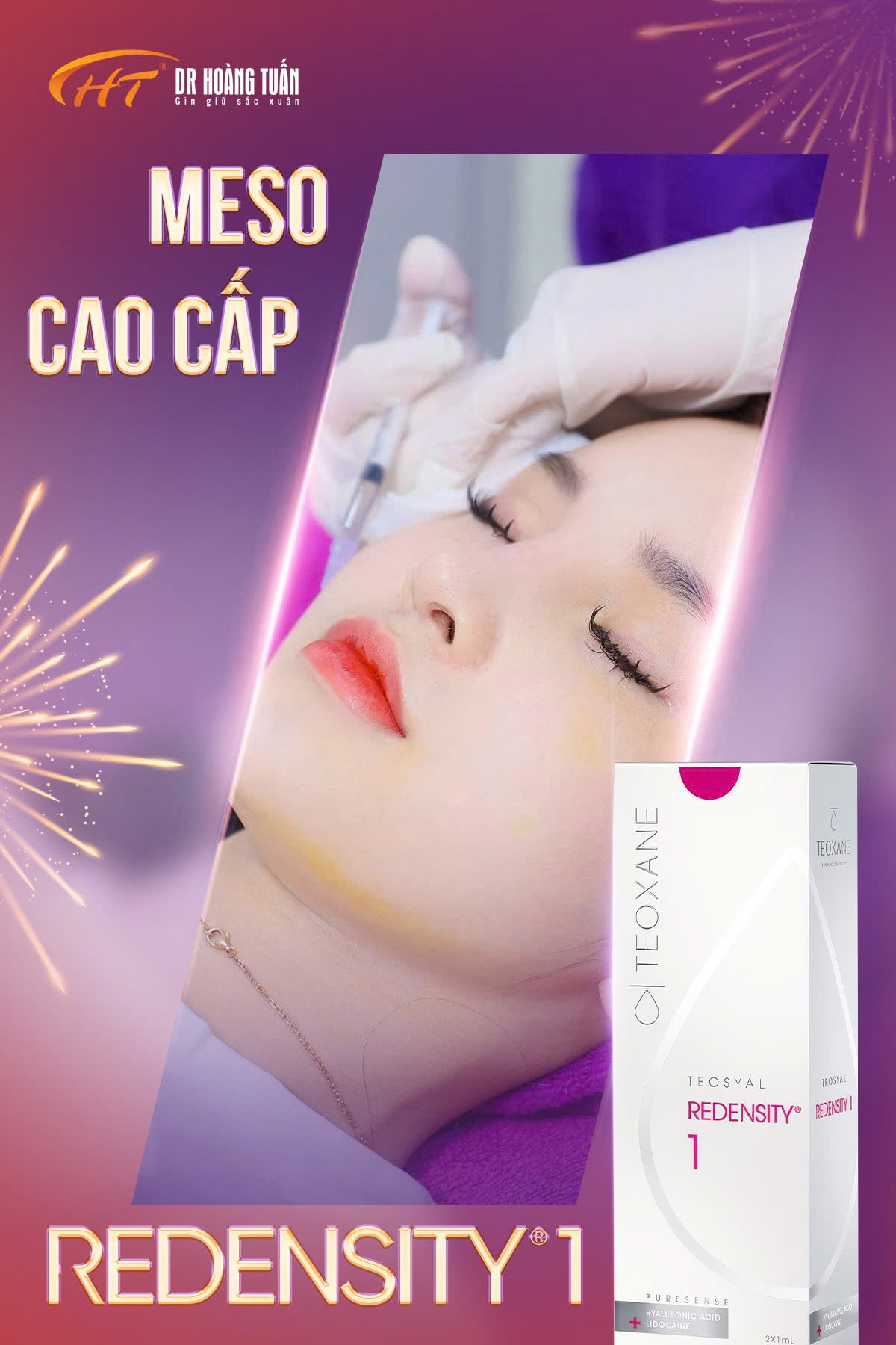 tiêm meso bao lâu thì đẹp