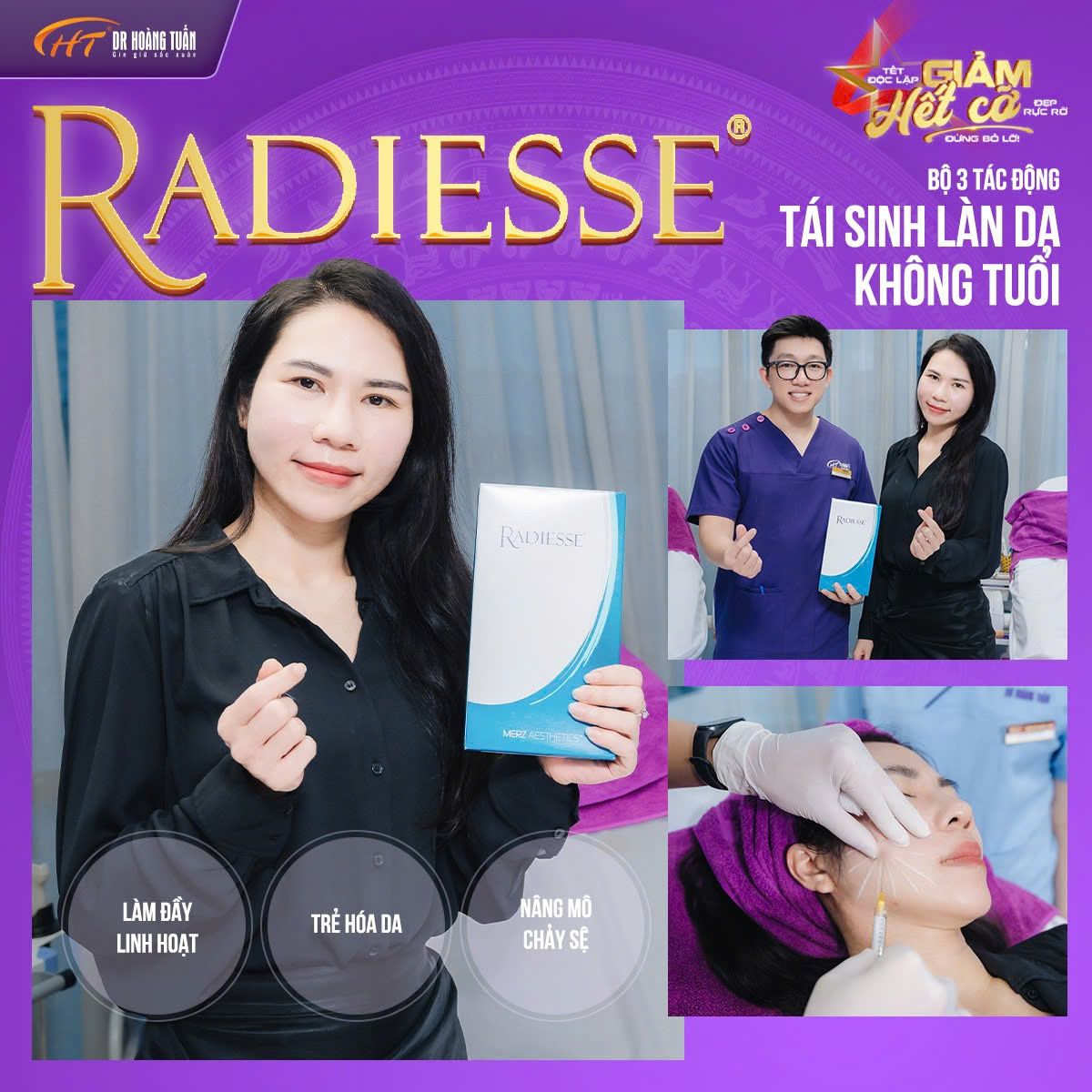 tiêm radiesse là gì