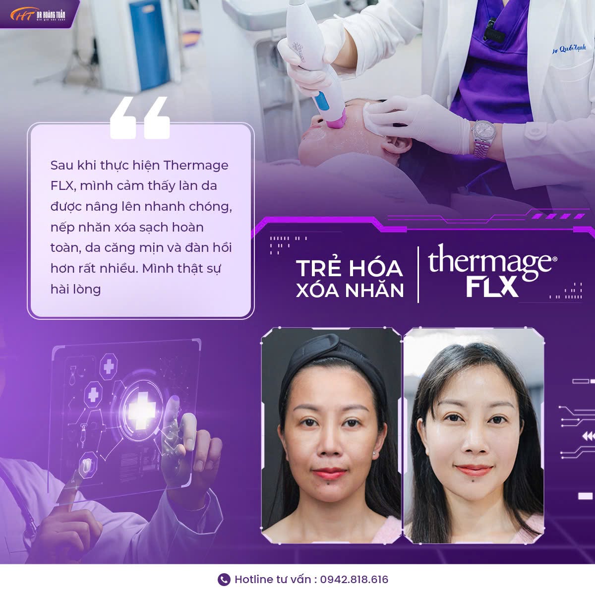 trẻ hóa da vùng cổ