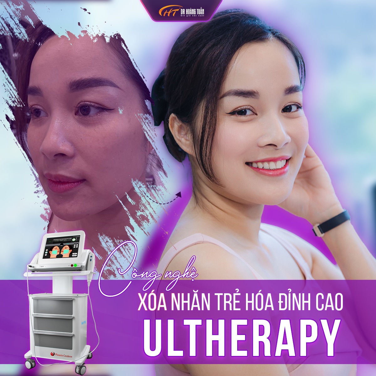 liệu trình trẻ hóa làn da