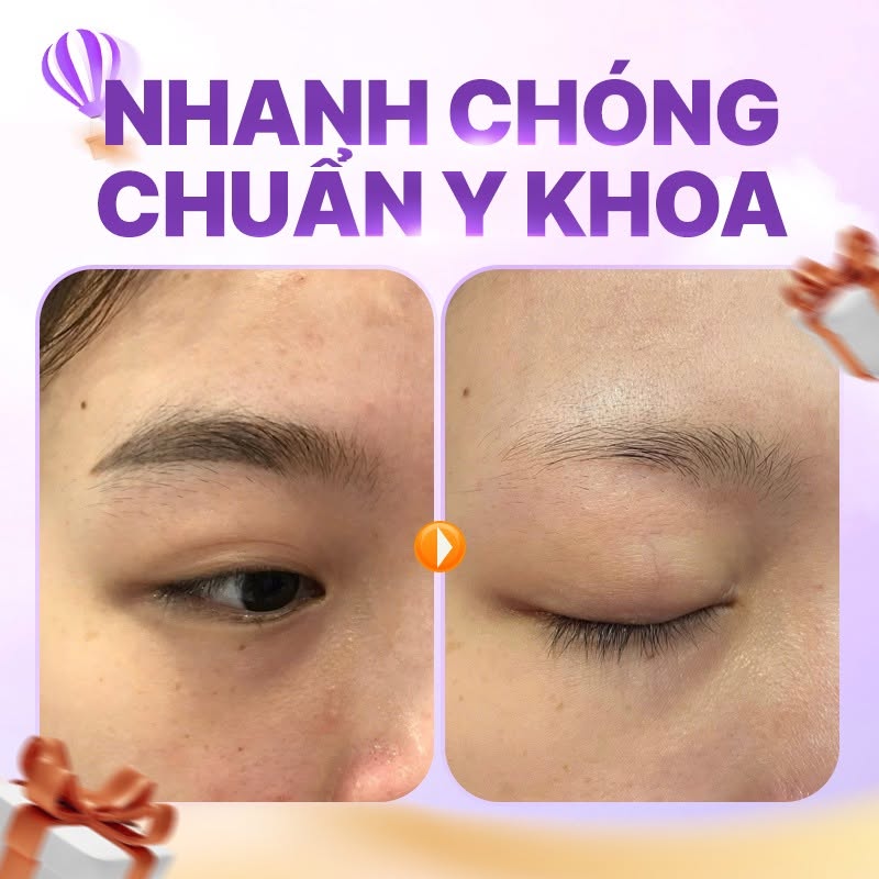 xóa xăm lông mày có bị rụng lông không