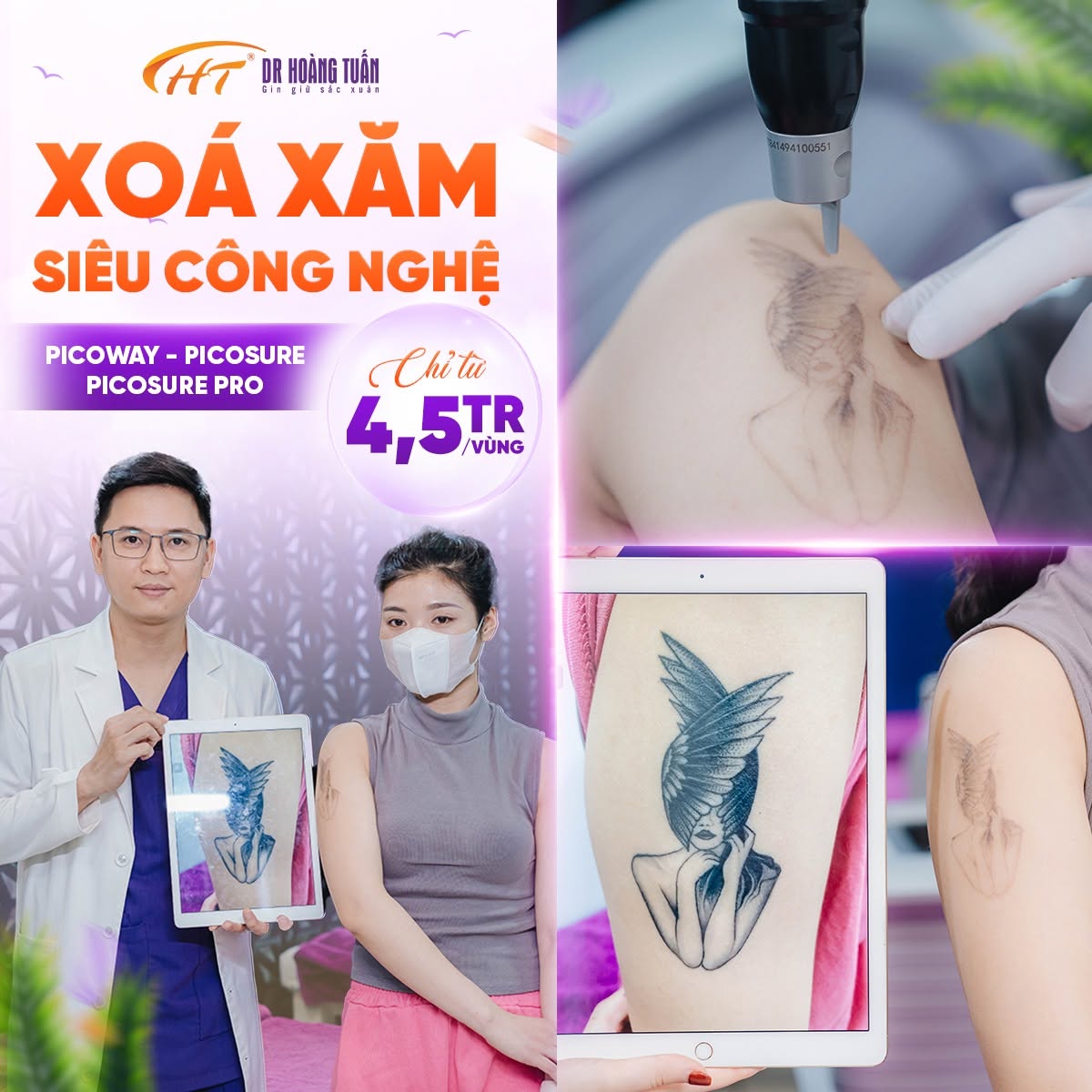 xoá xăm bị bọng nước