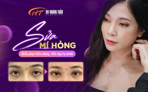 Sửa mí hỏng