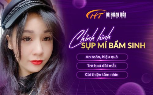 Chỉnh Hình Sụp Mí Bẩm Sinh