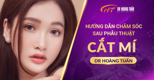 Hướng Dẫn Chăm Sóc Sau Phẫu Thuật Cắt Mí