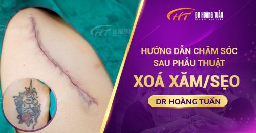 Hướng Dẫn Chăm Sóc Sau Phẫu Thuật Xoá Xăm/Sẹo