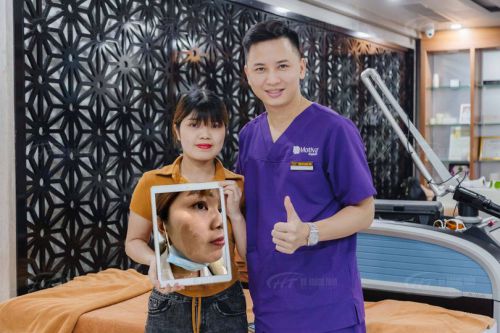 Điều trị bớt sắc tố bằng laser có tái phát không?