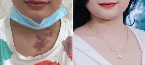 Nguyễn Thúy Quỳnh