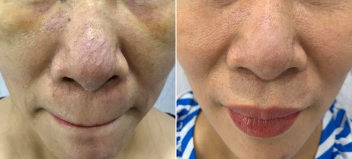 Nguyễn Thanh Thảo