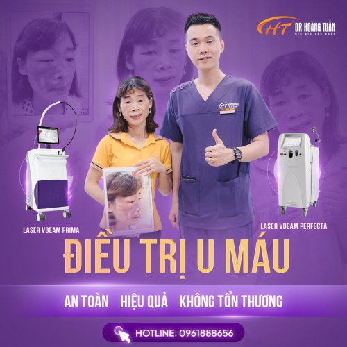 Điều trị u máu bằng laser có ưu điểm gì?