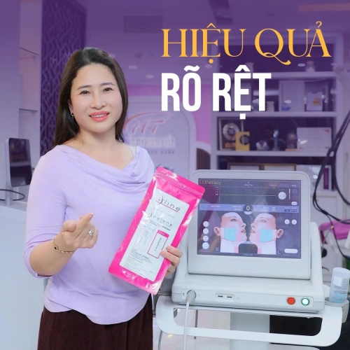 Căng chỉ da mặt được bao lâu? Bác sĩ da liễu giải đáp