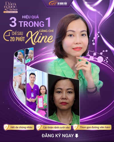 Căng da mặt bằng chỉ có nguy hiểm không? Sự thật có thể bạn chưa biết