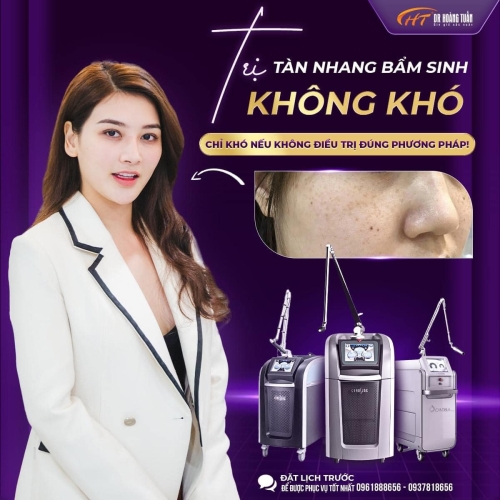 Nám da phải làm sao? Cách cải thiện làn da nám hiệu quả