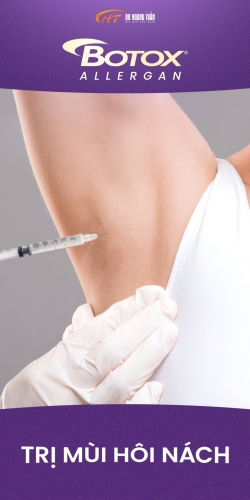 Tiêm botox trị hôi nách và những điều bạn cần biết
