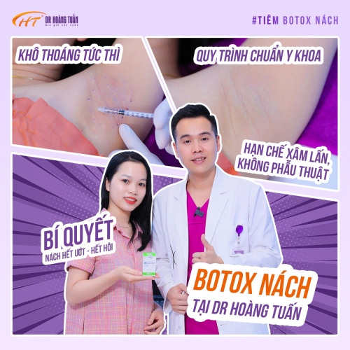 Tiêm botox nách có ảnh hưởng gì không? Lưu ý quan trọng để đảm bảo an toàn