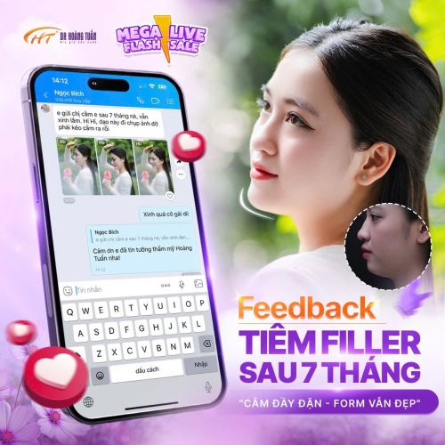 Tiêm Filler cằm bao lâu thì vào form? Các yếu tố ảnh hưởng đến kết quả