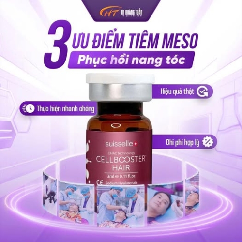 Tiêm Meso tóc có thực sự hiệu quả? Những điều bạn cần biết