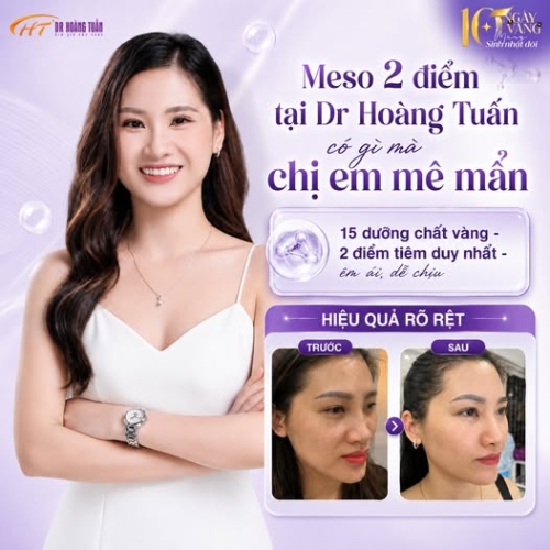 Tiêm Meso được bao lâu? Cách duy trì hiệu quả lâu dài