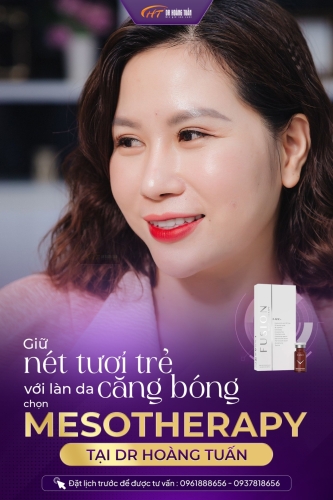 Tiêm meso giá bao nhiêu? Lợi ích của phương pháp tiêm meso