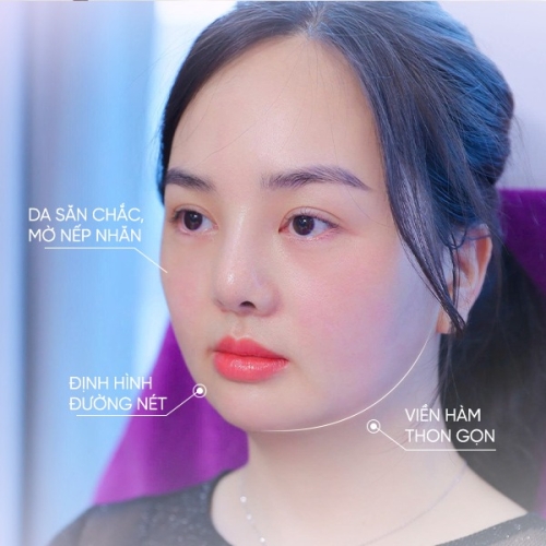 Ultherapy prime có tác dụng gì? Hiệu quả nâng cơ, xóa nhăn ra sao?